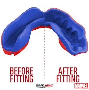 Ochraniacz na zęby SAFEJAWZ  Marvel Spider Man Senior